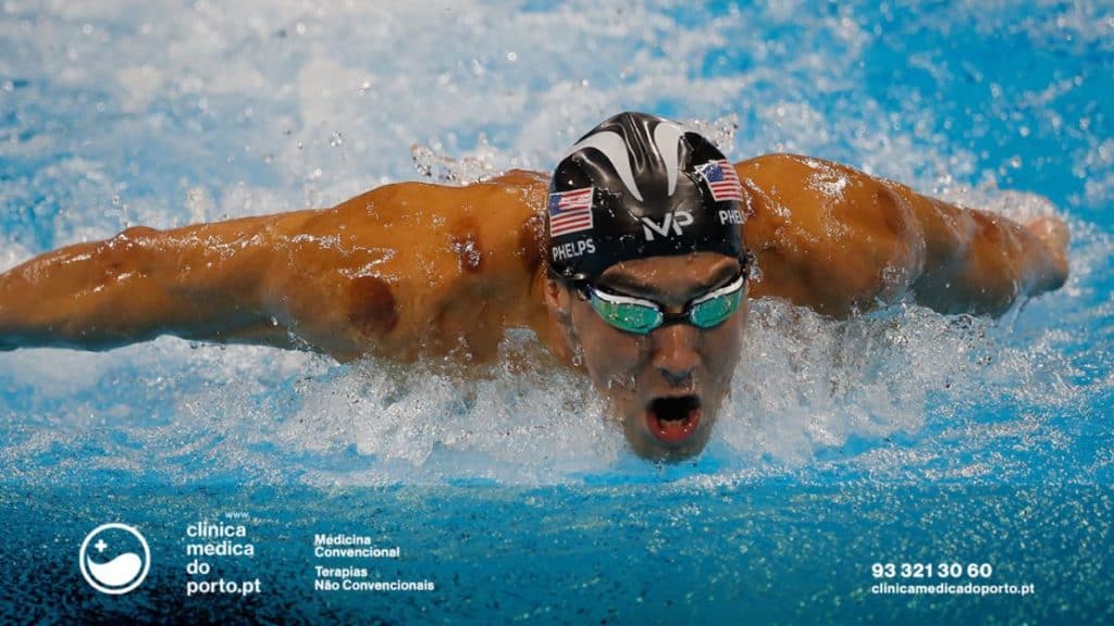 cupping-ventosas-ventosaterapia-clinica-medica-do-porto-1