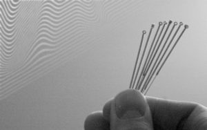 acupuntura-medicina-chinesa-evidencia-efeito-patologia