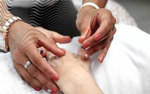acupuntura-insonia-clinica-medica-do-porto