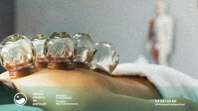 Pessoa a realizar tratamento de Cupping ou Ventosaterapia englobado na consulta de Medicina Chinesa