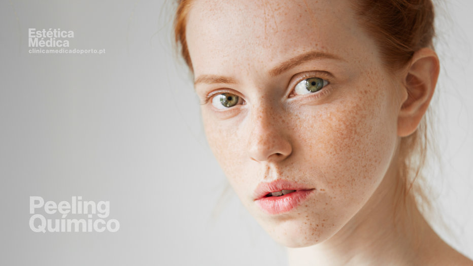 Mulher com um sorriso radiante, mostrando as suas sardas e manchas no rosto de forma proeminente, exaltando beleza natural e confiança